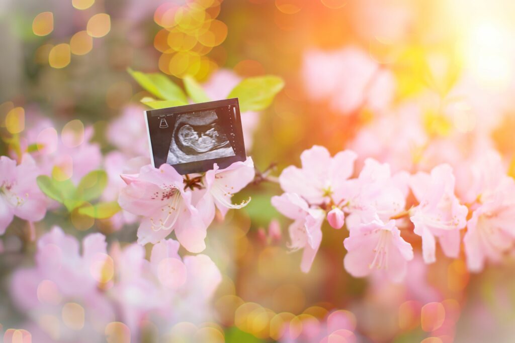 Pregnancy Announcement Idea with Sonogram